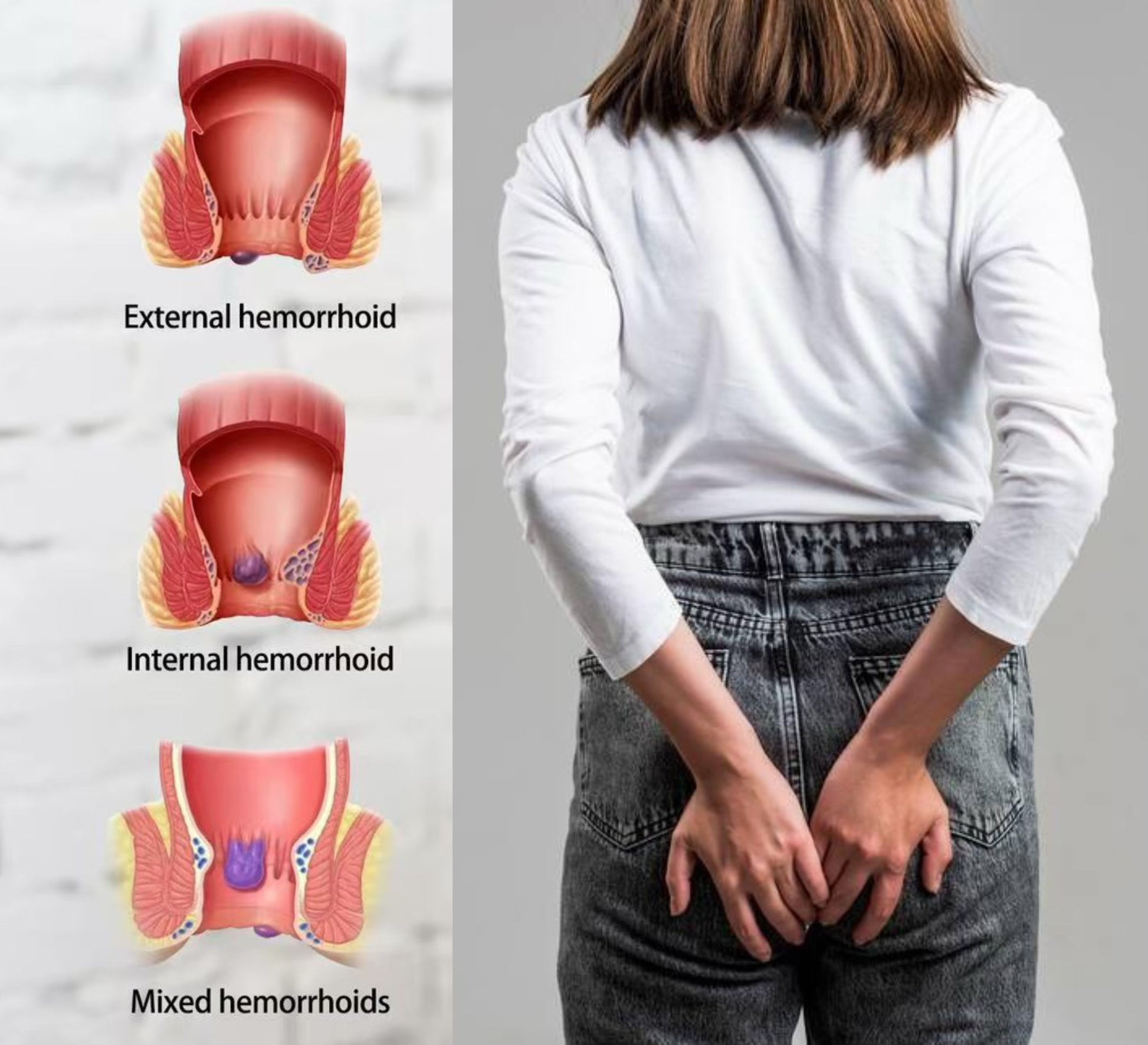 BEETSEC Herbal Cream - BEETSEC